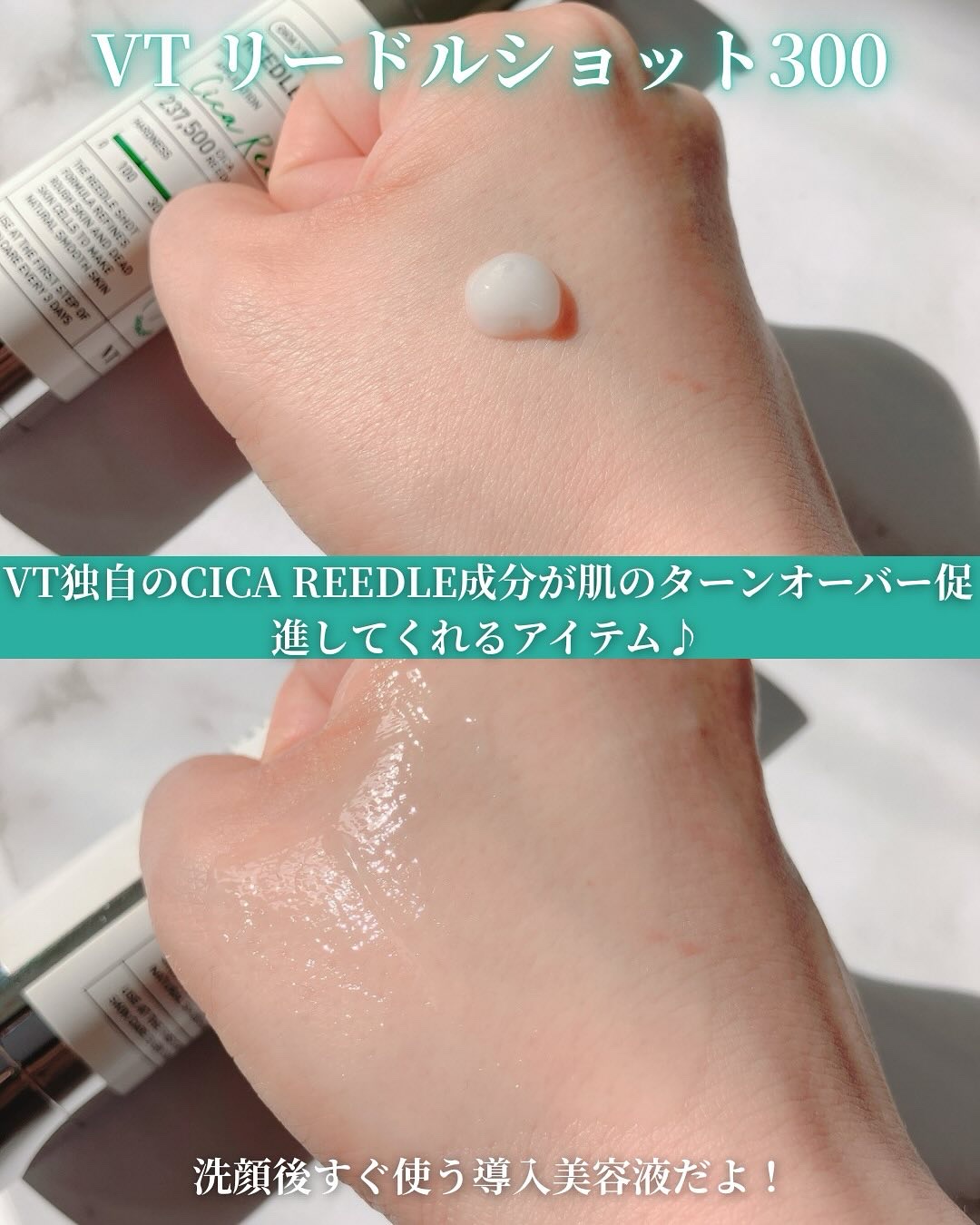 リードルショット300/VT/美容液を使ったクチコミ（2枚目）