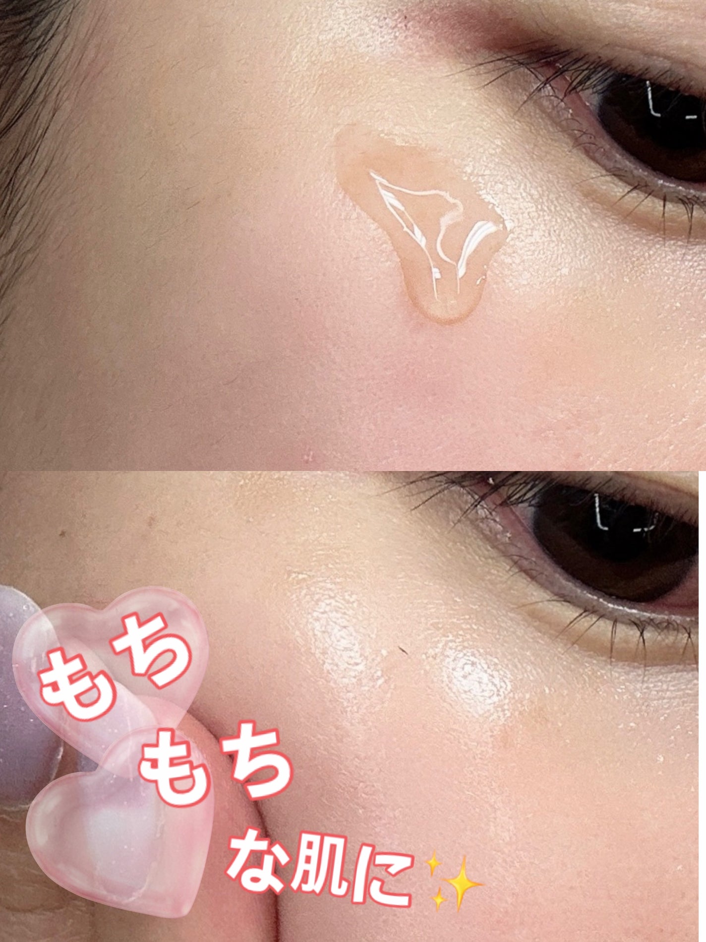 PDRNカフェインショット/IOPE/美容液を使ったクチコミ(5枚目)