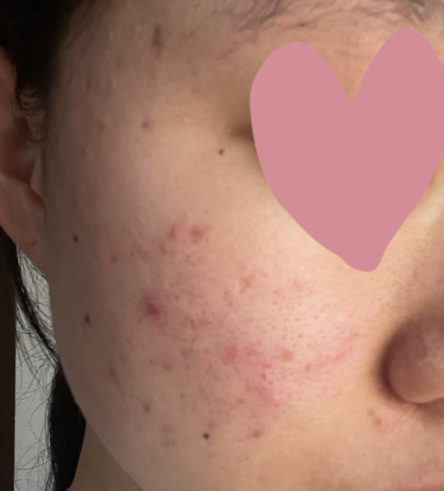 パワーマスク SP/ラッシュ/スクラブ・ゴマージュを使ったクチコミ（3枚目）