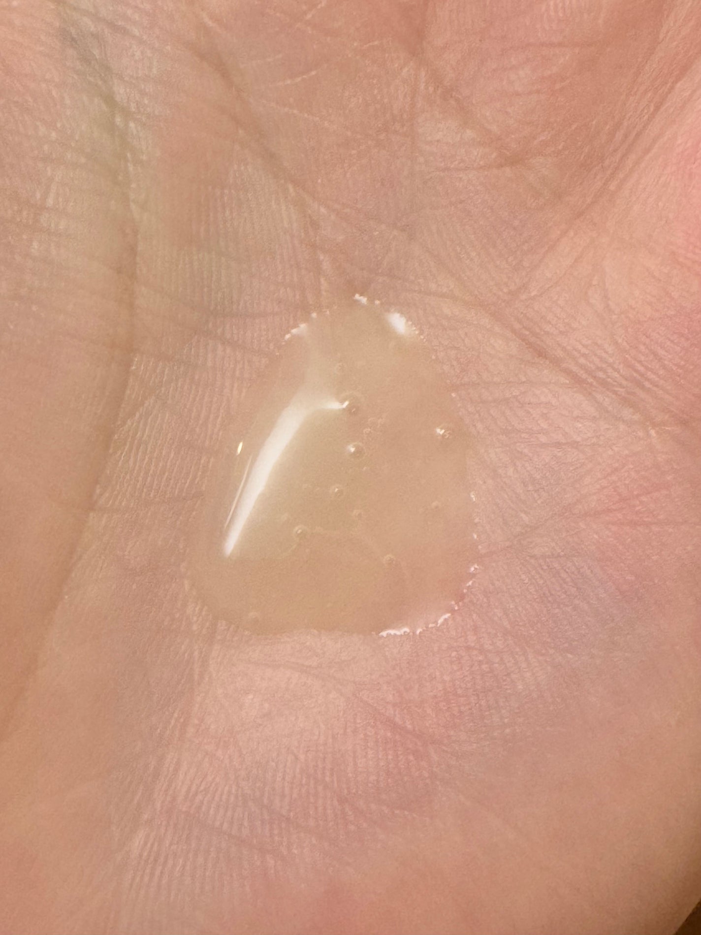 ホワイトロジスト ネオジェネシス ブライトニング コンセントレイト/DECORTÉ/美容液を使ったクチコミ(2枚目)