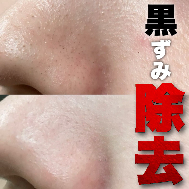 サボン クレンジングオイル ブルークレイ/&honey/オイルクレンジングを使ったクチコミ（1枚目）