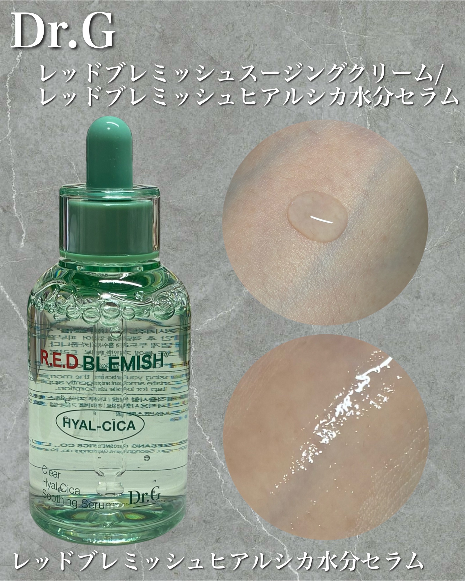 レッドブレミッシュ クリアスージングクリーム/Dr.G/フェイスクリームを使ったクチコミ（3枚目）