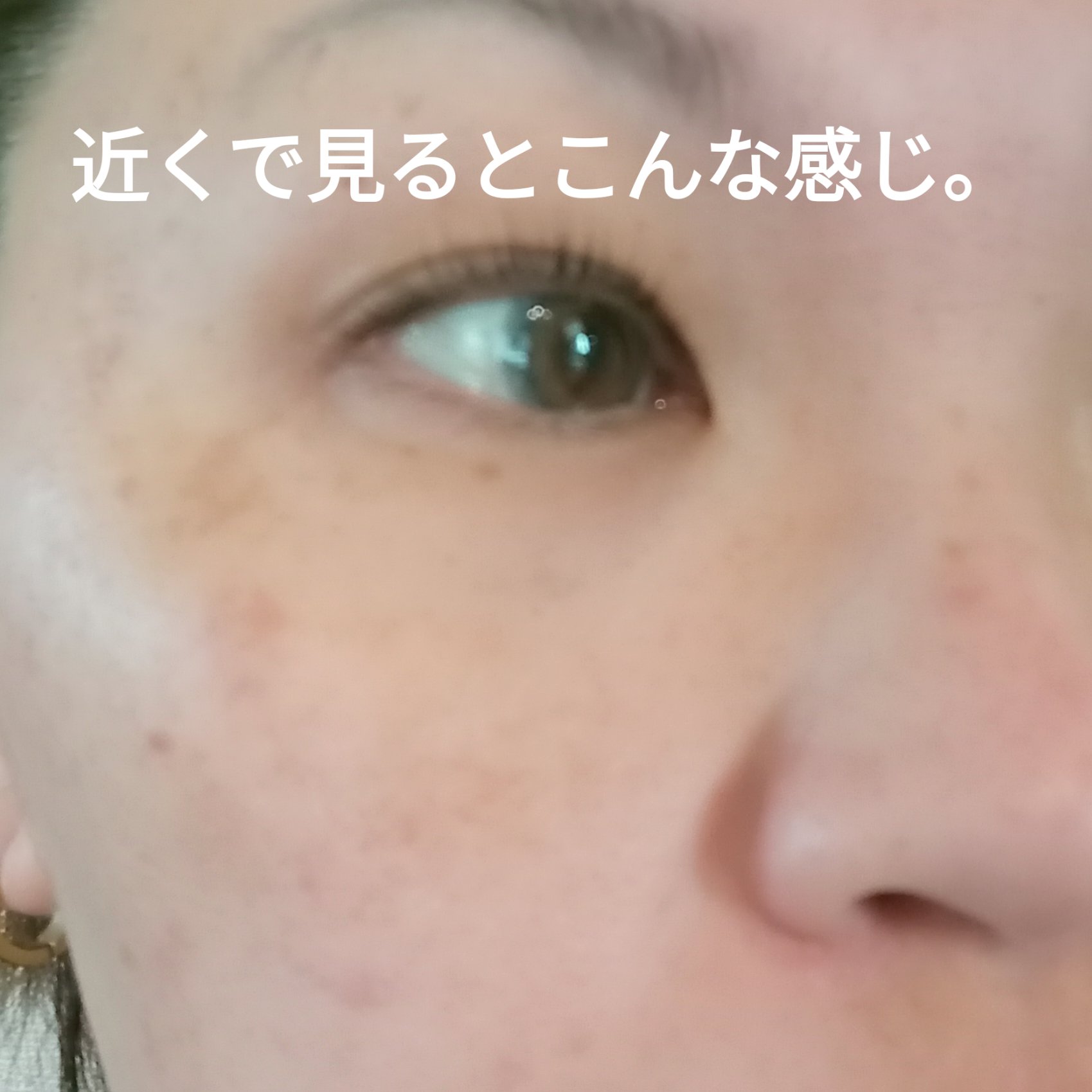 ダーマペン4/SBC/その他を使ったクチコミ（3枚目）