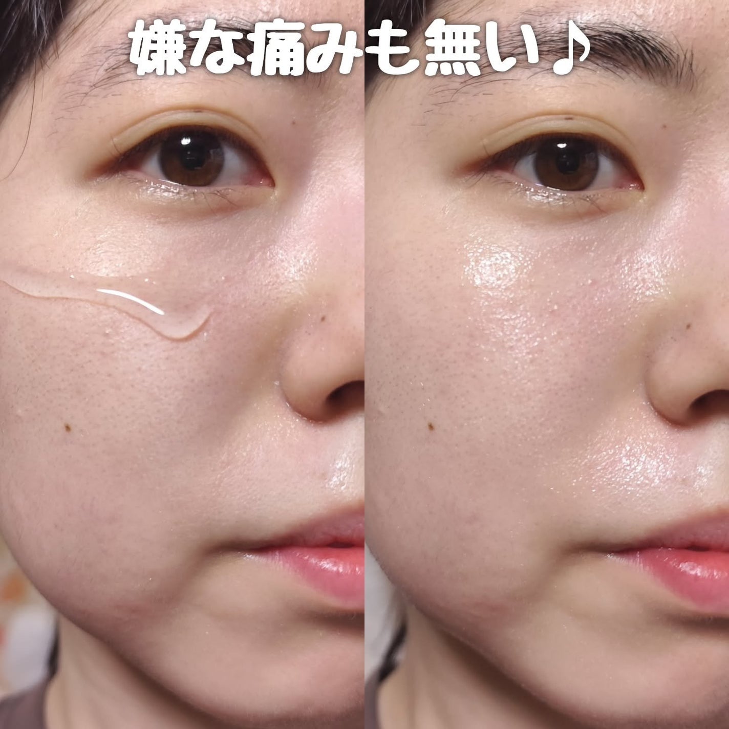 ナイトリペアニードルショット/HARILOGY/美容液を使ったクチコミ(5枚目)