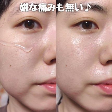 ナイトリペアニードルショット/HARILOGY/美容液を使ったクチコミ(5枚目)