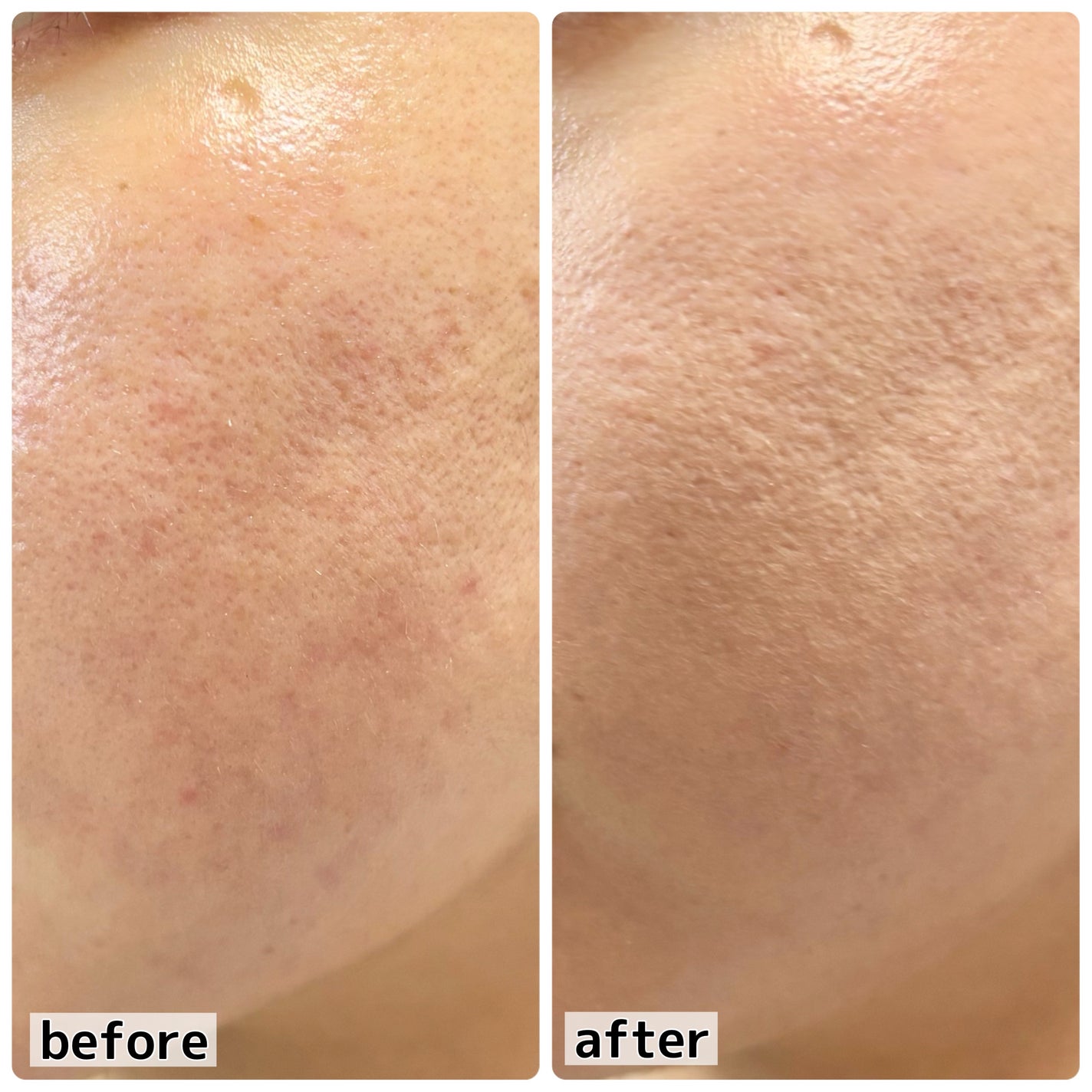 ハイパーカバーフィットクッション  グラファイト/APRILSKIN/クッションファンデーションを使ったクチコミ(5枚目)