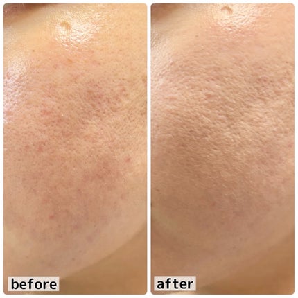 ハイパーカバーフィットクッション  グラファイト/APRILSKIN/クッションファンデーションを使ったクチコミ(5枚目)