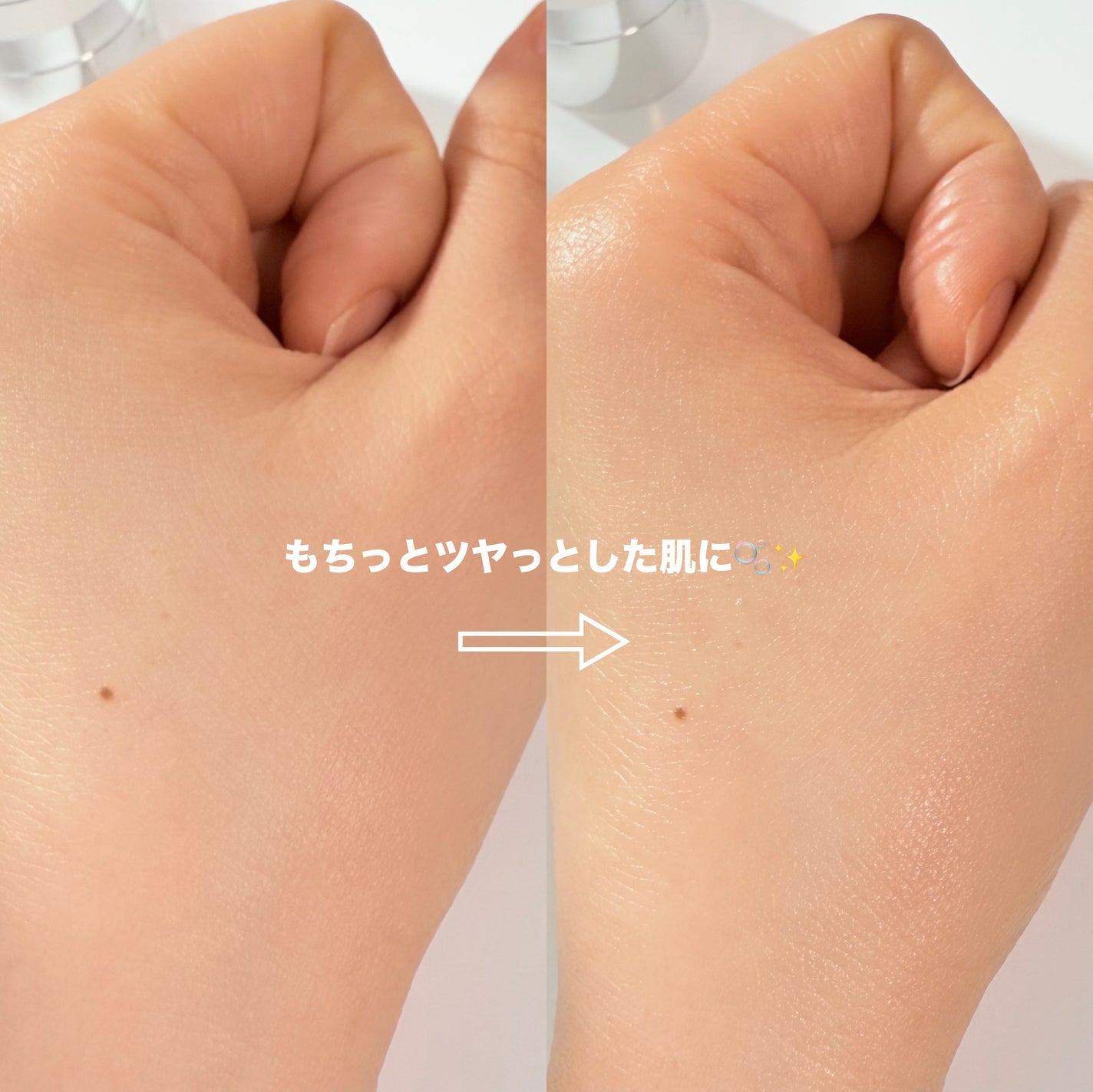 リードルショット300/VT/美容液を使ったクチコミ(5枚目)