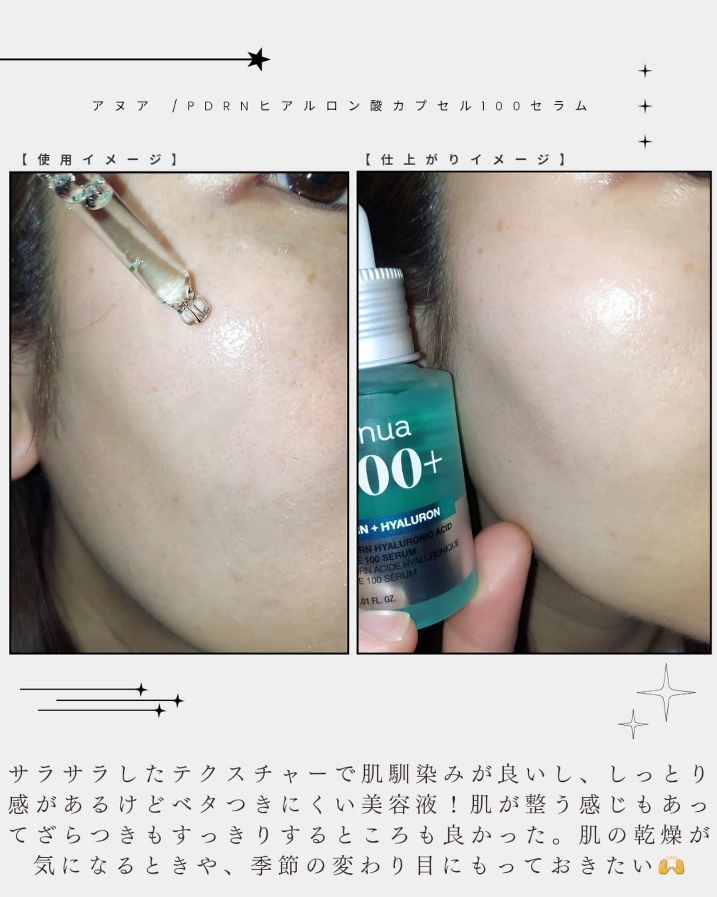 PDRNヒアルロン酸カプセル100セラム/Anua/美容液を使ったクチコミ(3枚目)