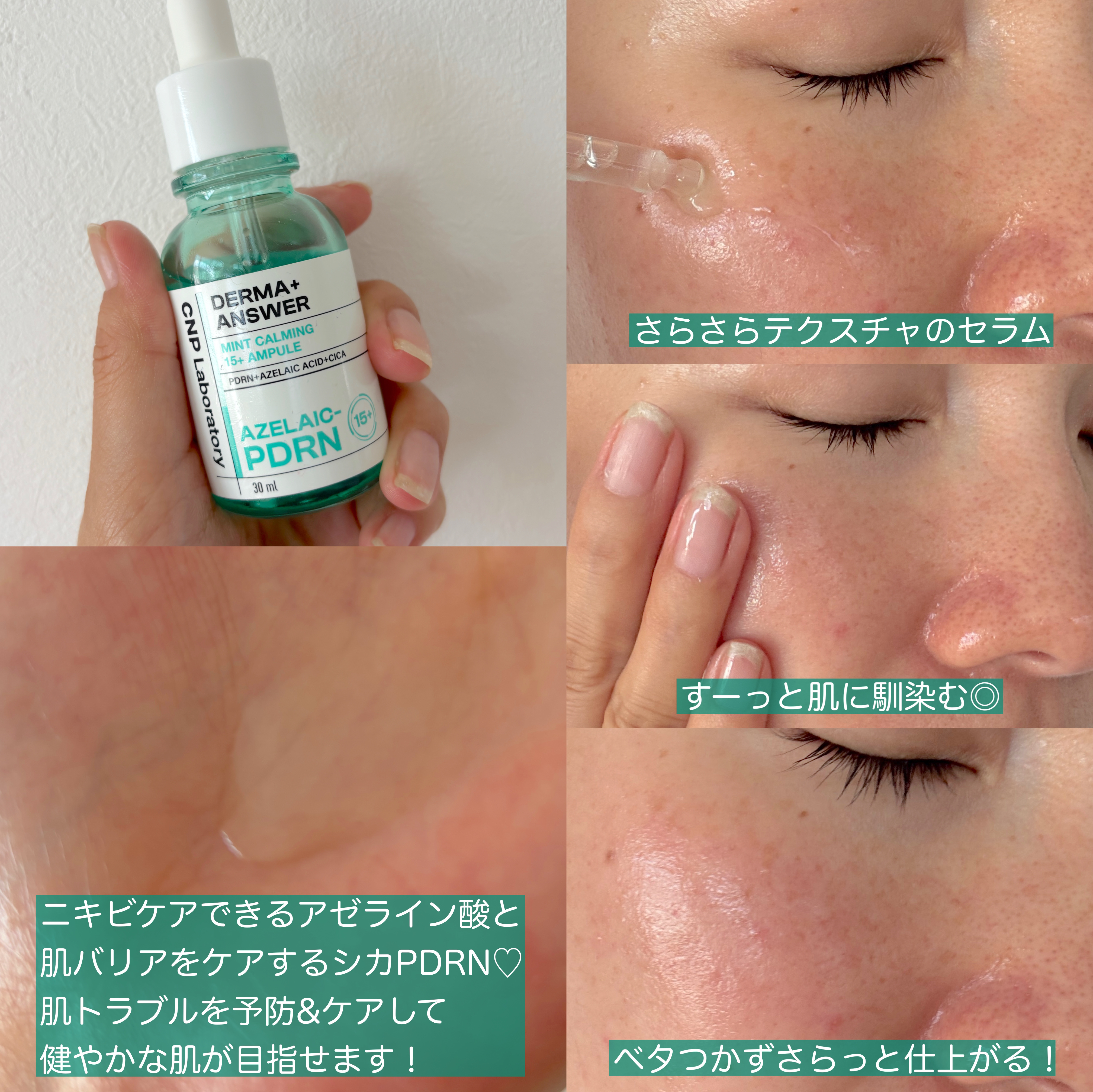 ダーマアンサーアゼライン酸ミントアンプル/CNP Laboratory/美容液を使ったクチコミ（2枚目）