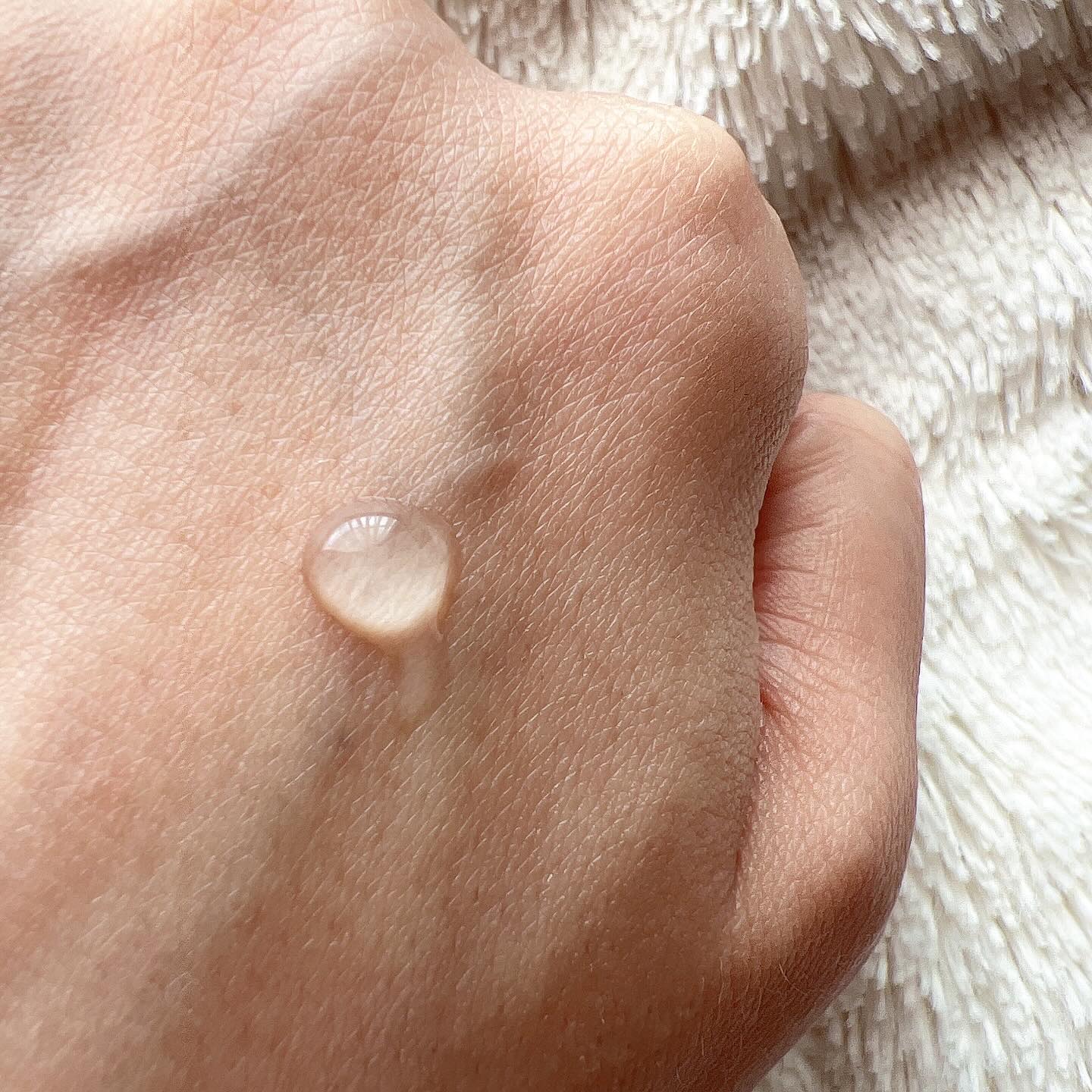 アクリンゲル/東亜製薬/その他スキンケアを使ったクチコミ（3枚目）