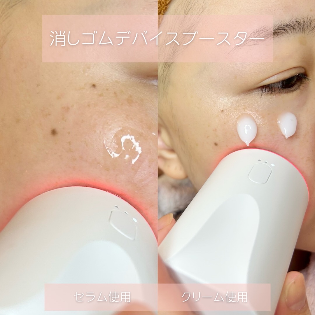 を使ったクチコミ（2枚目）