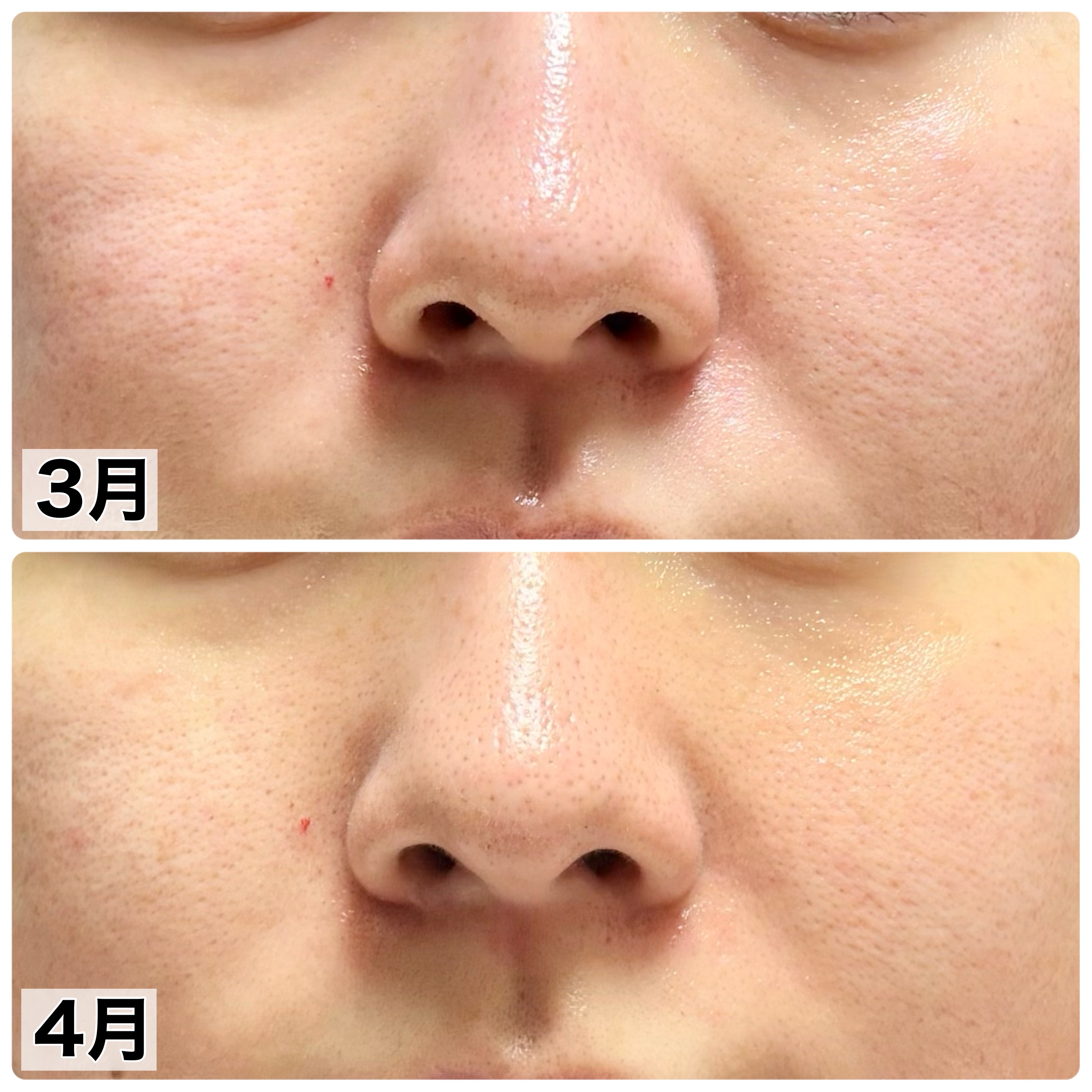 フローラディエンス モイスチャライジングスフレソープ 紙/EDOBIO/洗顔石鹸を使ったクチコミ（2枚目）