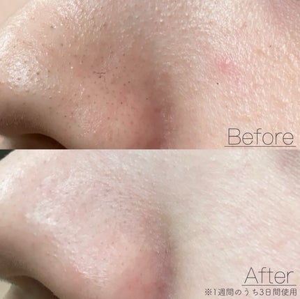 サボン クレンジングオイル ブルークレイ/&honey/オイルクレンジングを使ったクチコミ(5枚目)