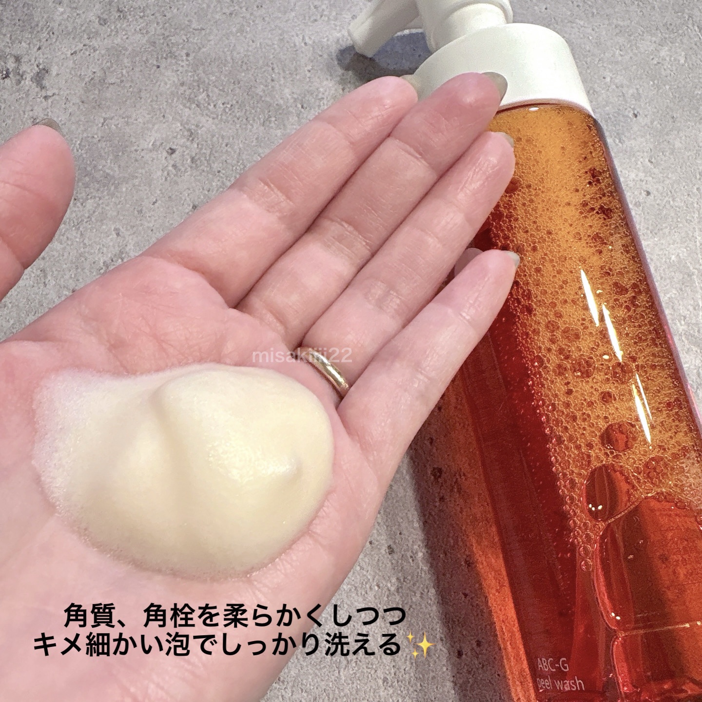 ABC-Gピールウォッシュ/ドクターケイ/泡洗顔を使ったクチコミ（2枚目）