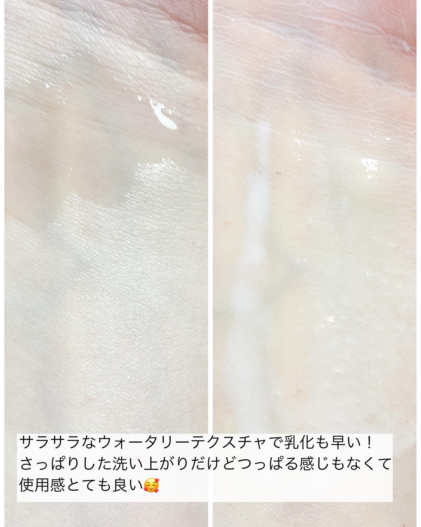 リードルS AZ ケアセラム/VT/美容液を使ったクチコミ（3枚目）