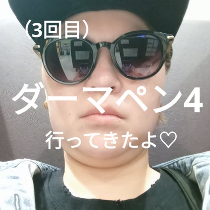 ダーマペン4/SBC/その他を使ったクチコミ(1枚目)