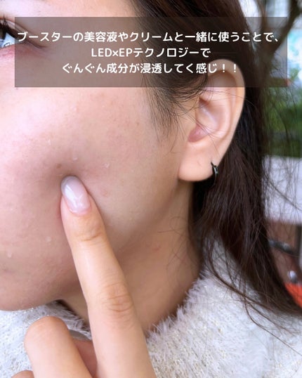 ぽんず。((フォロバ強化中)) on LIPS 「👩🔬❤️🤍【PR】話題の美顔器×スキンブースターで本気の美..」(7枚目)