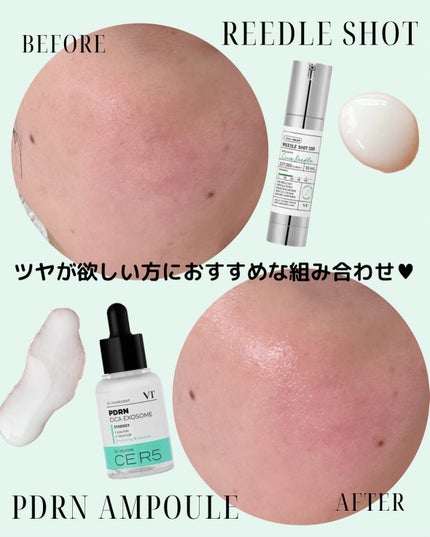 リードルショット300/VT/美容液を使ったクチコミ(6枚目)