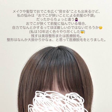 ねり*・ on LIPS 「でこ狭卒業したら分厚い前髪がようやく消えました🙌🏻✄-----..」(6枚目)