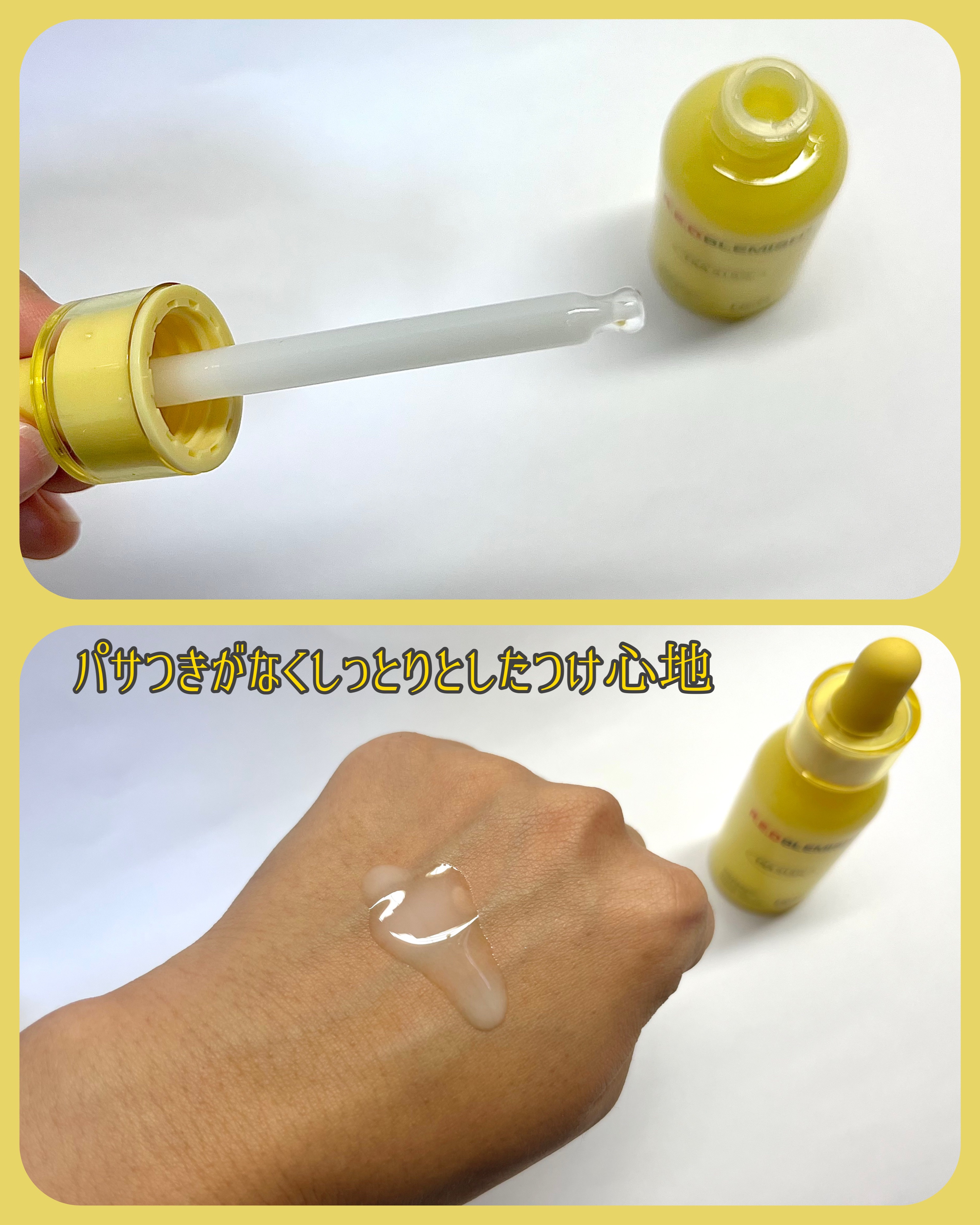 レッドブレミッシュ リペアスージングクリーム/Dr.G/フェイスクリームを使ったクチコミ（3枚目）