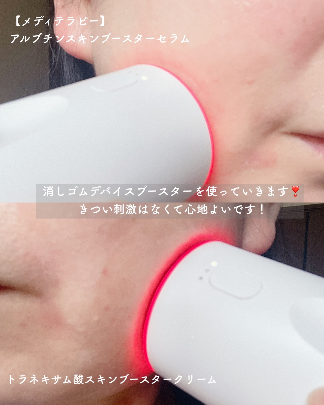 を使ったクチコミ（2枚目）