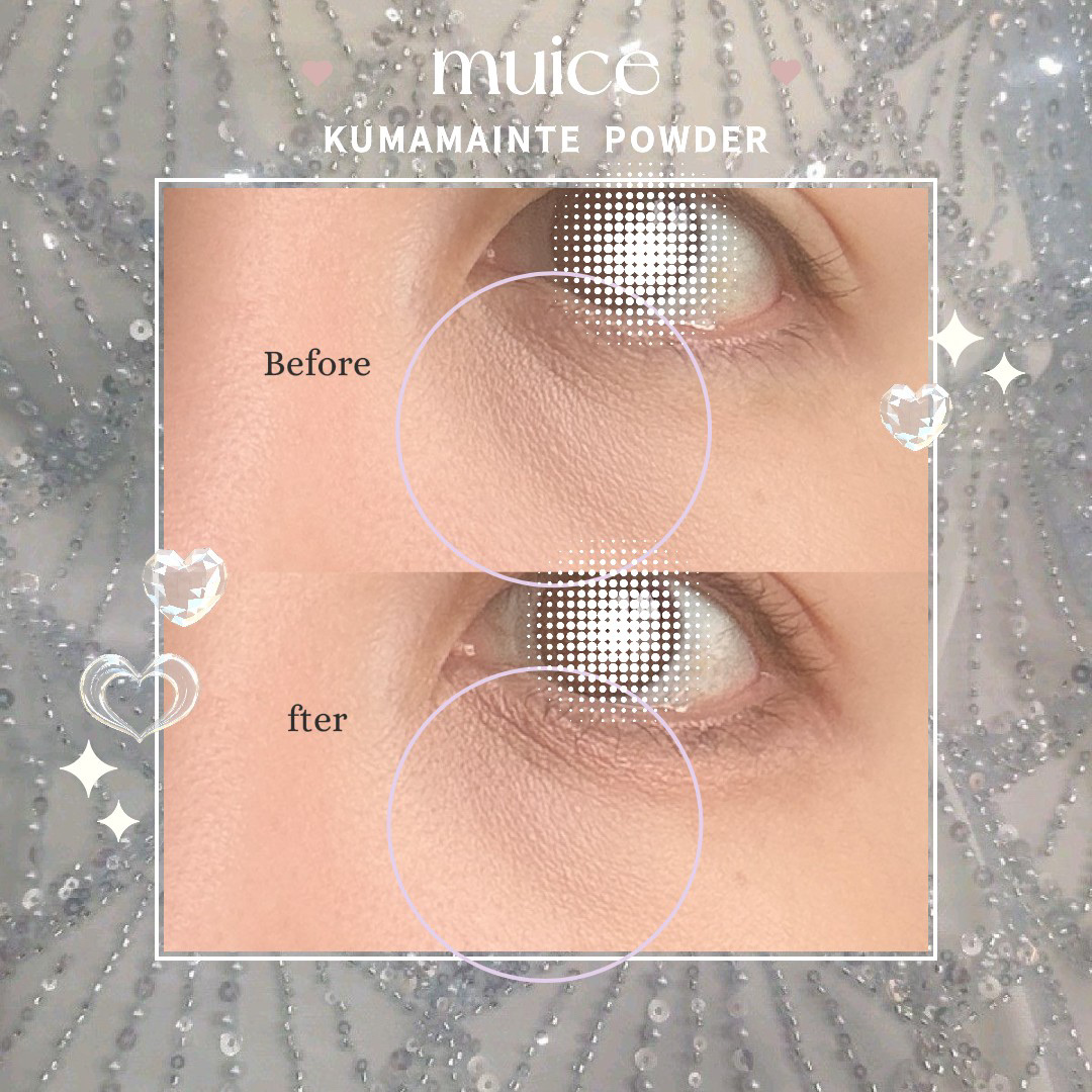 クマメンテパウダー/muice/パウダーコンシーラーを使ったクチコミ（2枚目）