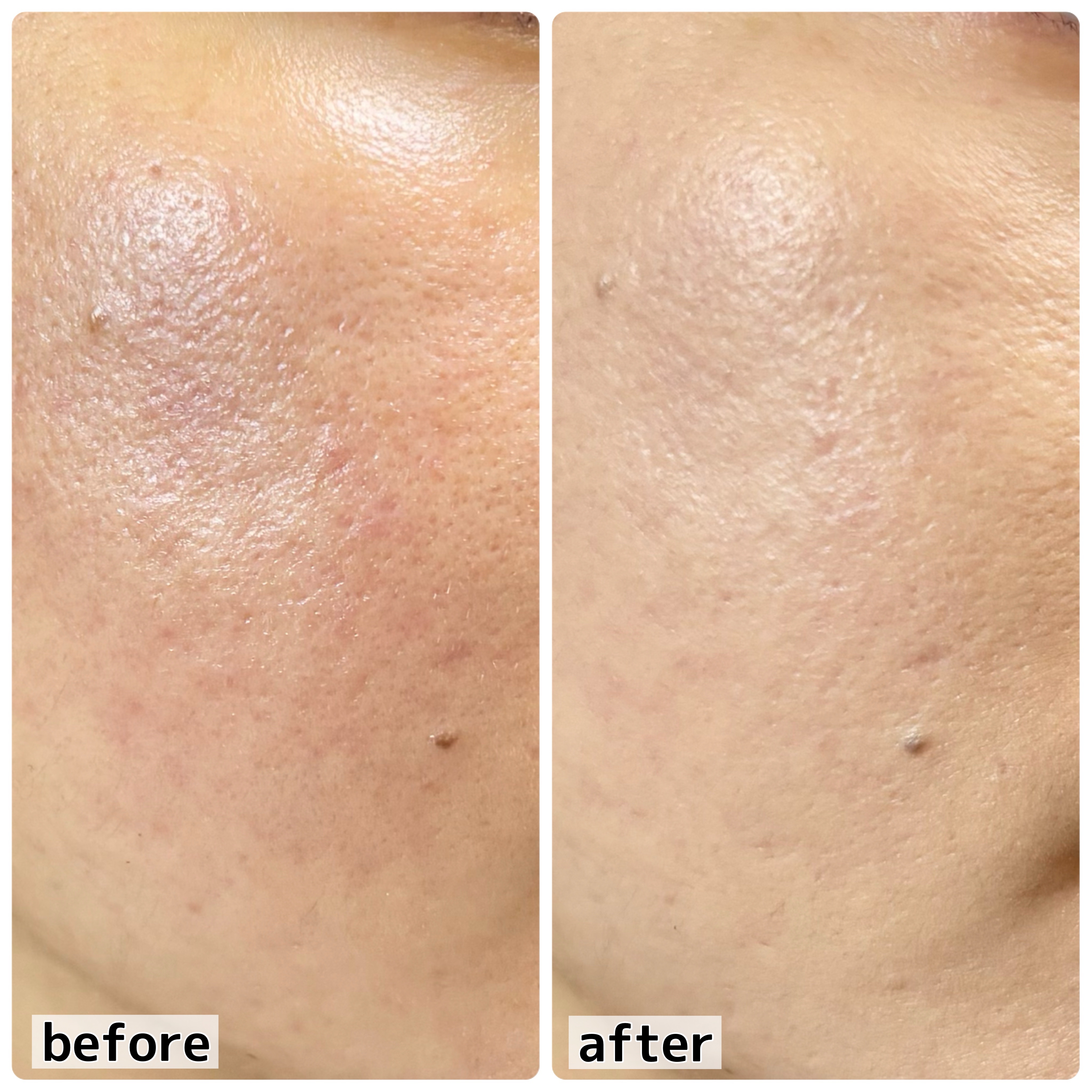 ハイパーカバーフィットクッション  グラファイト/APRILSKIN/クッションファンデーションを使ったクチコミ（3枚目）