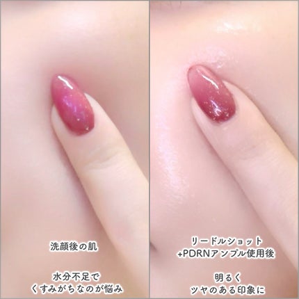 リードルショット300/VT/美容液を使ったクチコミ(10枚目)