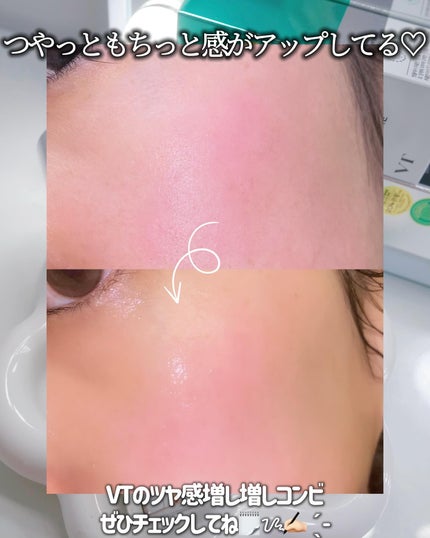 リードルショット300/VT/美容液を使ったクチコミ(6枚目)