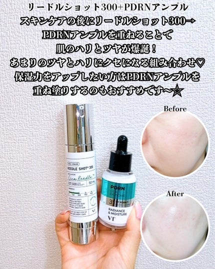 リードルショット300/VT/美容液を使ったクチコミ(6枚目)