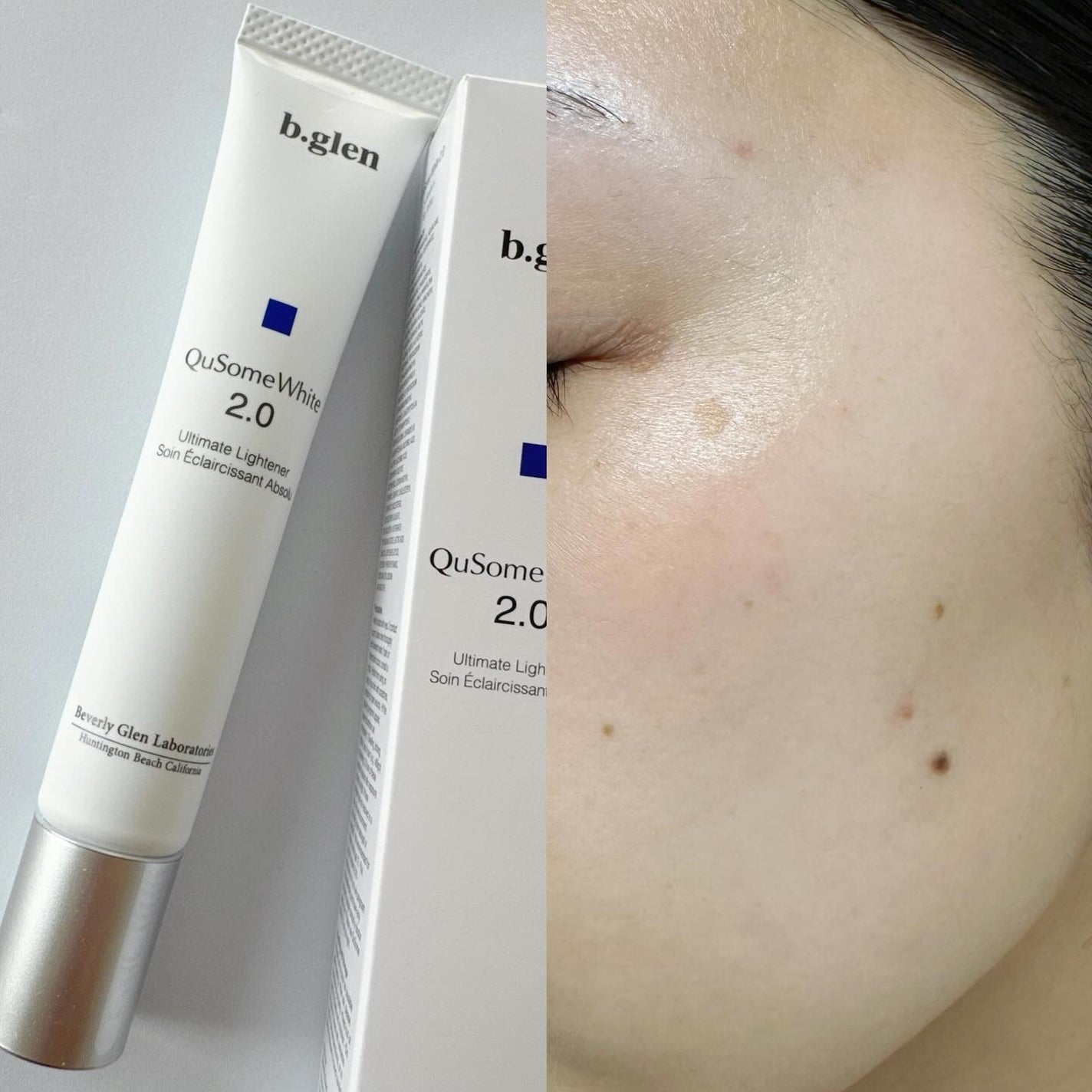 QuSomeホワイト2.0/b.glen/美容液を使ったクチコミ(4枚目)