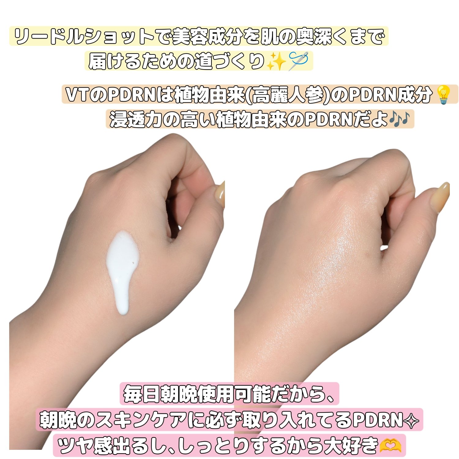 リードルショット300/VT/美容液を使ったクチコミ（2枚目）