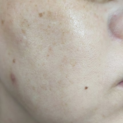 まっつん on LIPS 「リアルバリアからレチノールとハリケアのシナジー成分で、たるんだ..」(5枚目)