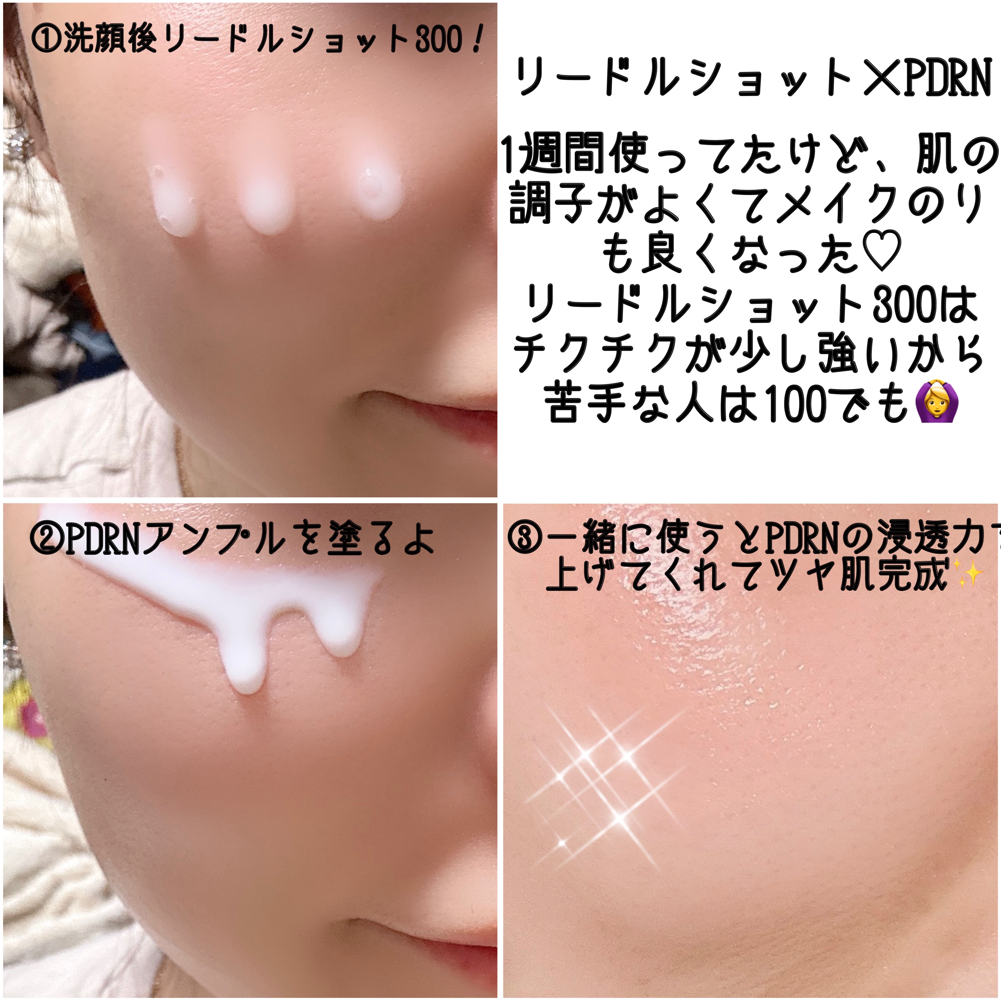 リードルショット300/VT/美容液を使ったクチコミ（2枚目）