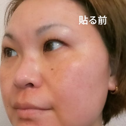 センテラ クイックカーミングパッド/SKIN1004/トナーパッドを使ったクチコミ(4枚目)