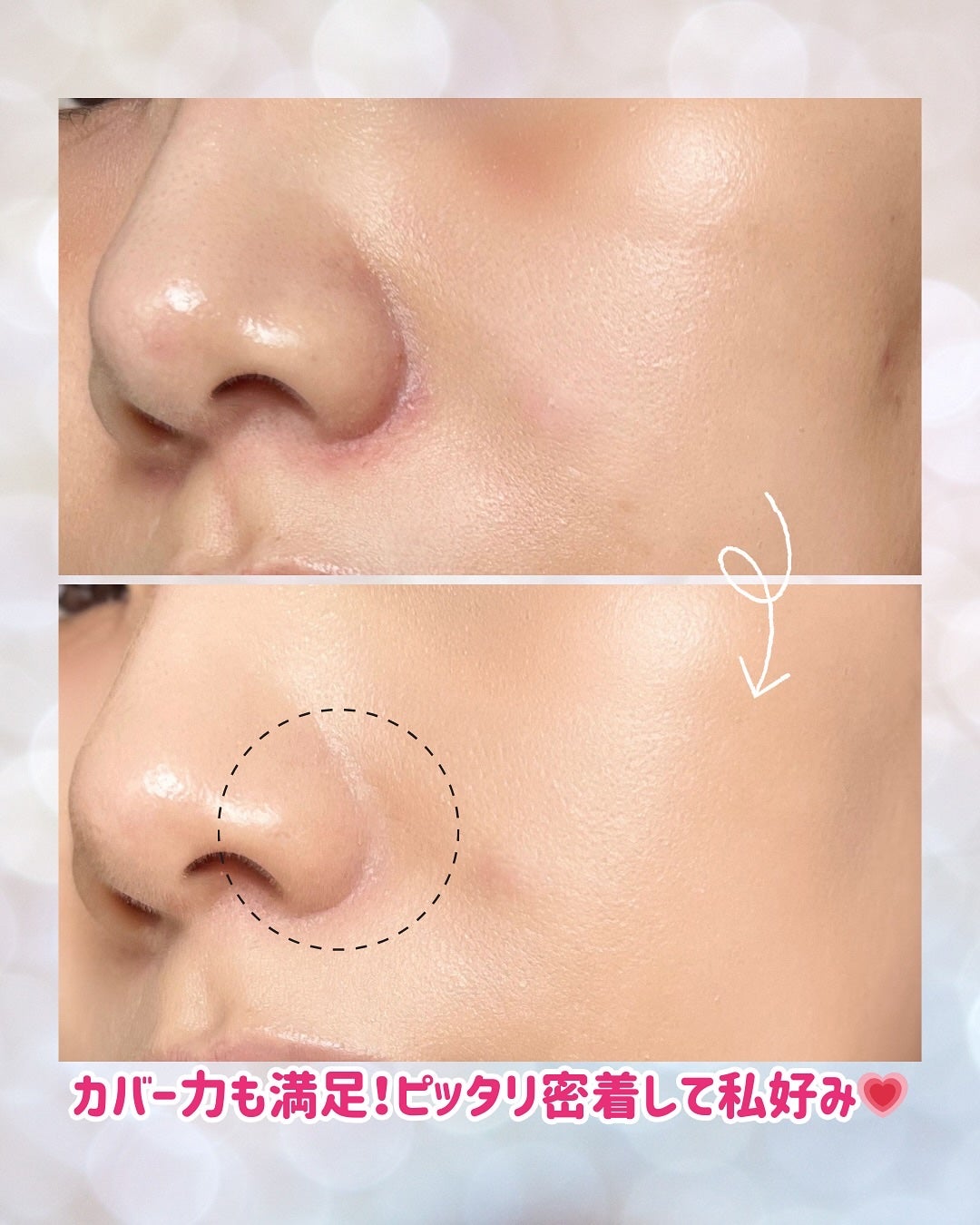 ダーマシンコンシーラー/23years old/リキッドコンシーラーを使ったクチコミ(3枚目)