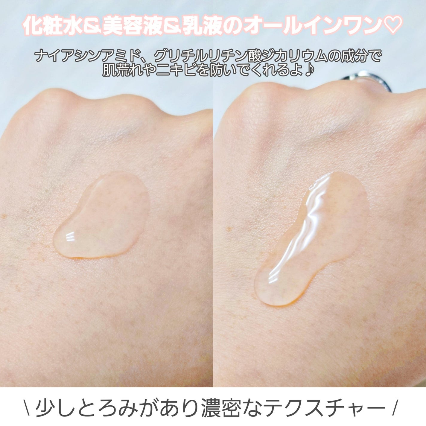 乾燥さん 薬用しっとり化粧液【医薬部外品】/乾燥さん/オールインワン化粧品を使ったクチコミ(3枚目)