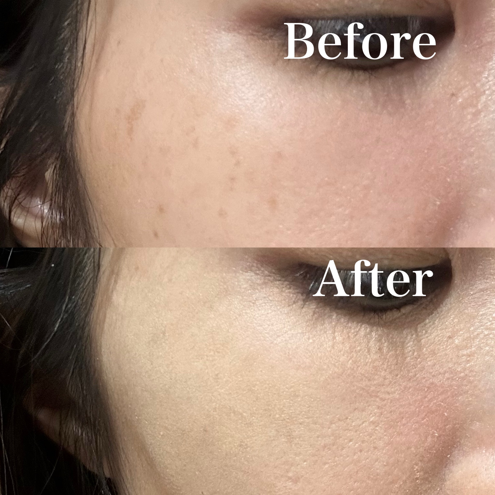 メルティフィットコンシーラー/インテグレート/パレットコンシーラーを使ったクチコミ（3枚目）