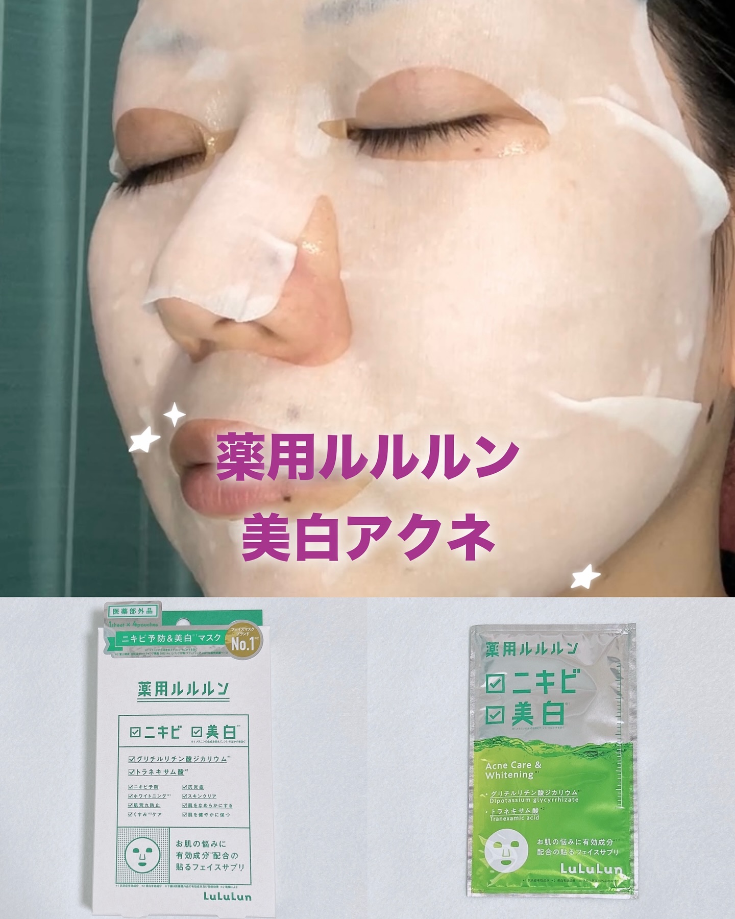 薬用ルルルン 美白アクネ/ルルルン/シートマスク・パックを使ったクチコミ（1枚目）