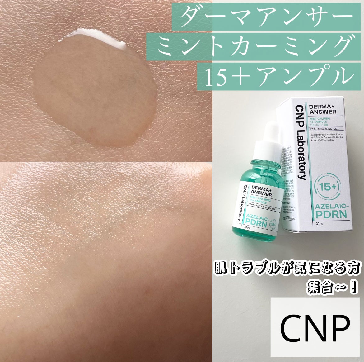 ダーマアンサーアゼライン酸ミントアンプル/CNP Laboratory/美容液を使ったクチコミ(1枚目)