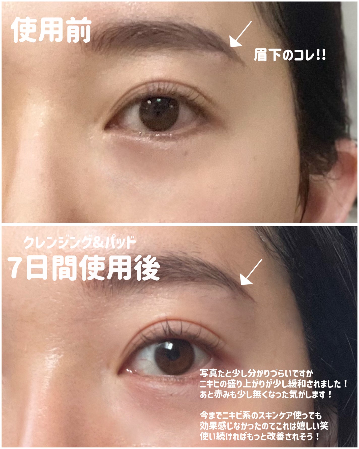 AZケア クレンジングオイル/VT/オイルクレンジングを使ったクチコミ(4枚目)