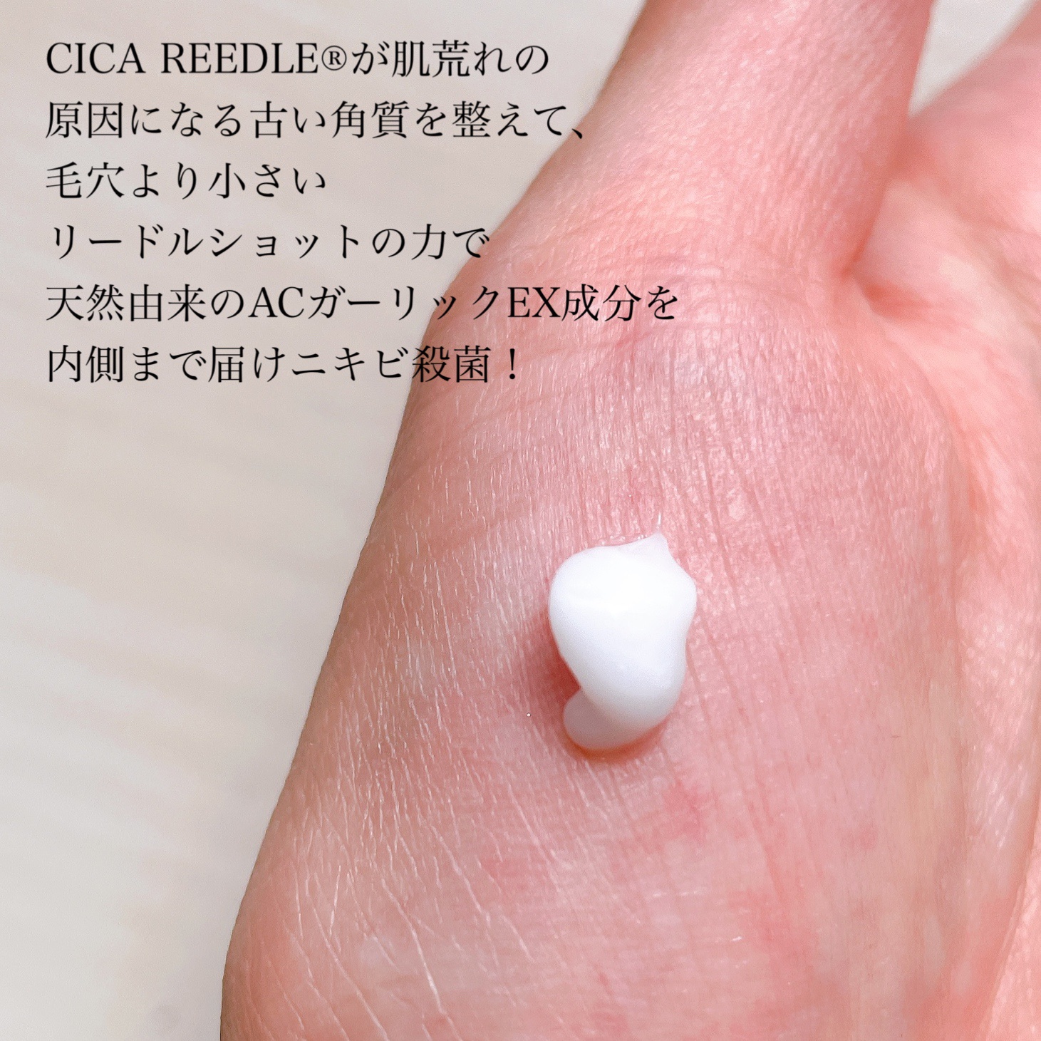 ガーリック リードルショット スポットクリーム/VT/フェイスクリームを使ったクチコミ（3枚目）