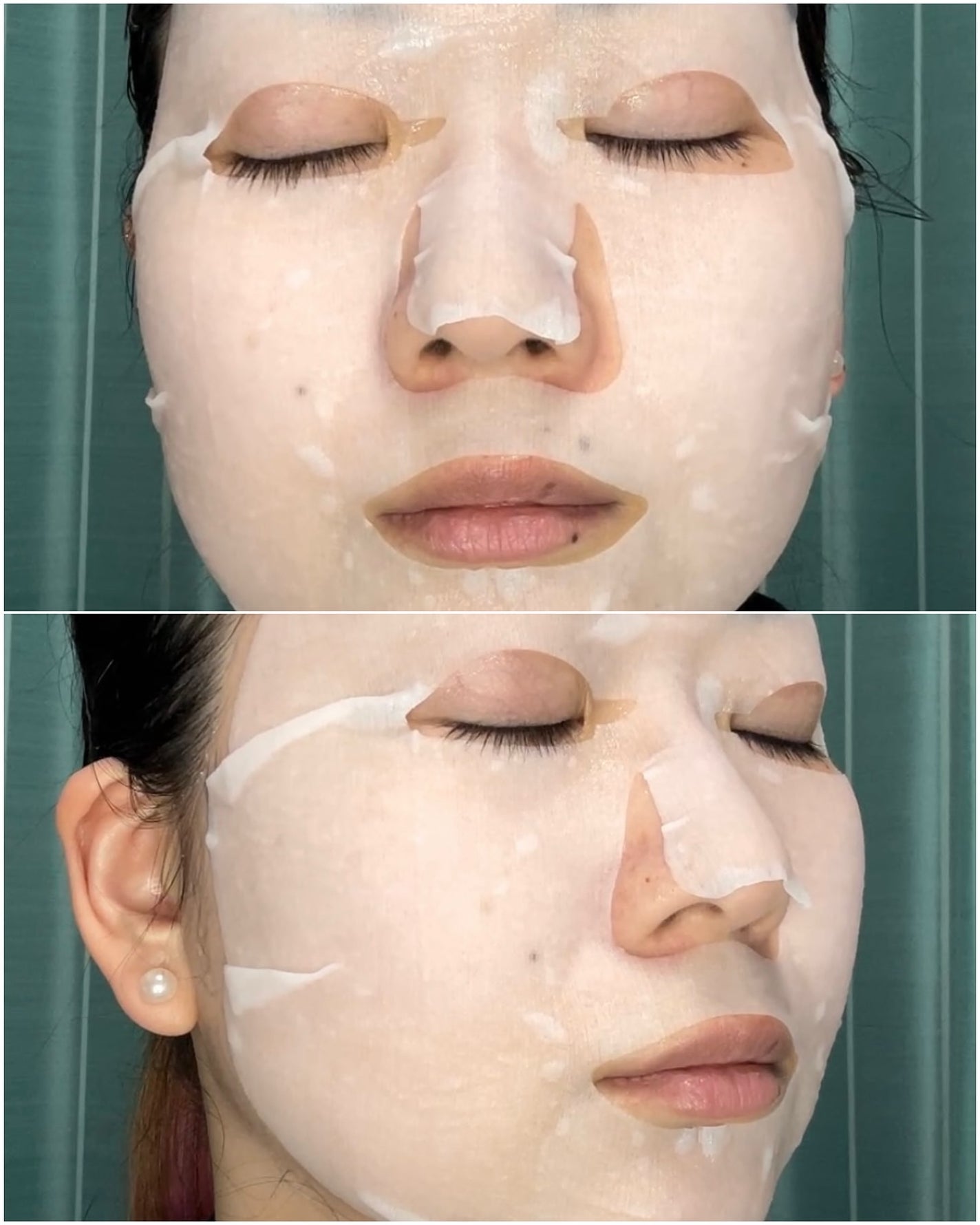 薬用ルルルン 美白アクネ/ルルルン/シートマスク・パックを使ったクチコミ(5枚目)