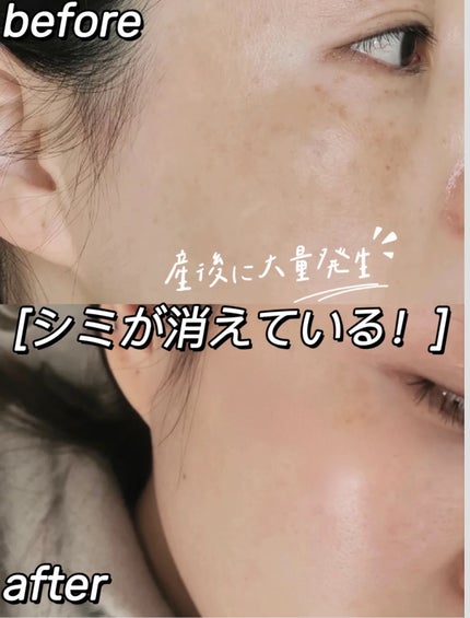 桃花姫プラセンタ/和漢SINCA/美容サプリメントを使ったクチコミ(4枚目)