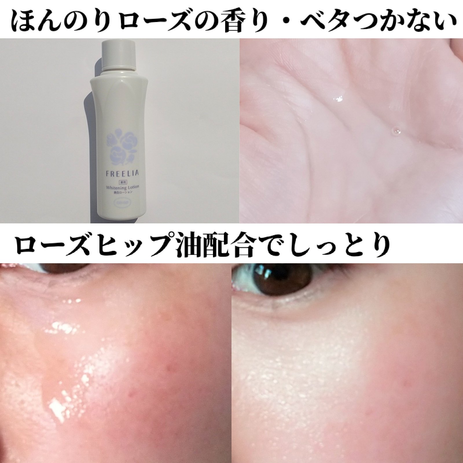 フリーリア 薬用美白ローションE/コープ/化粧水を使ったクチコミ（2枚目）