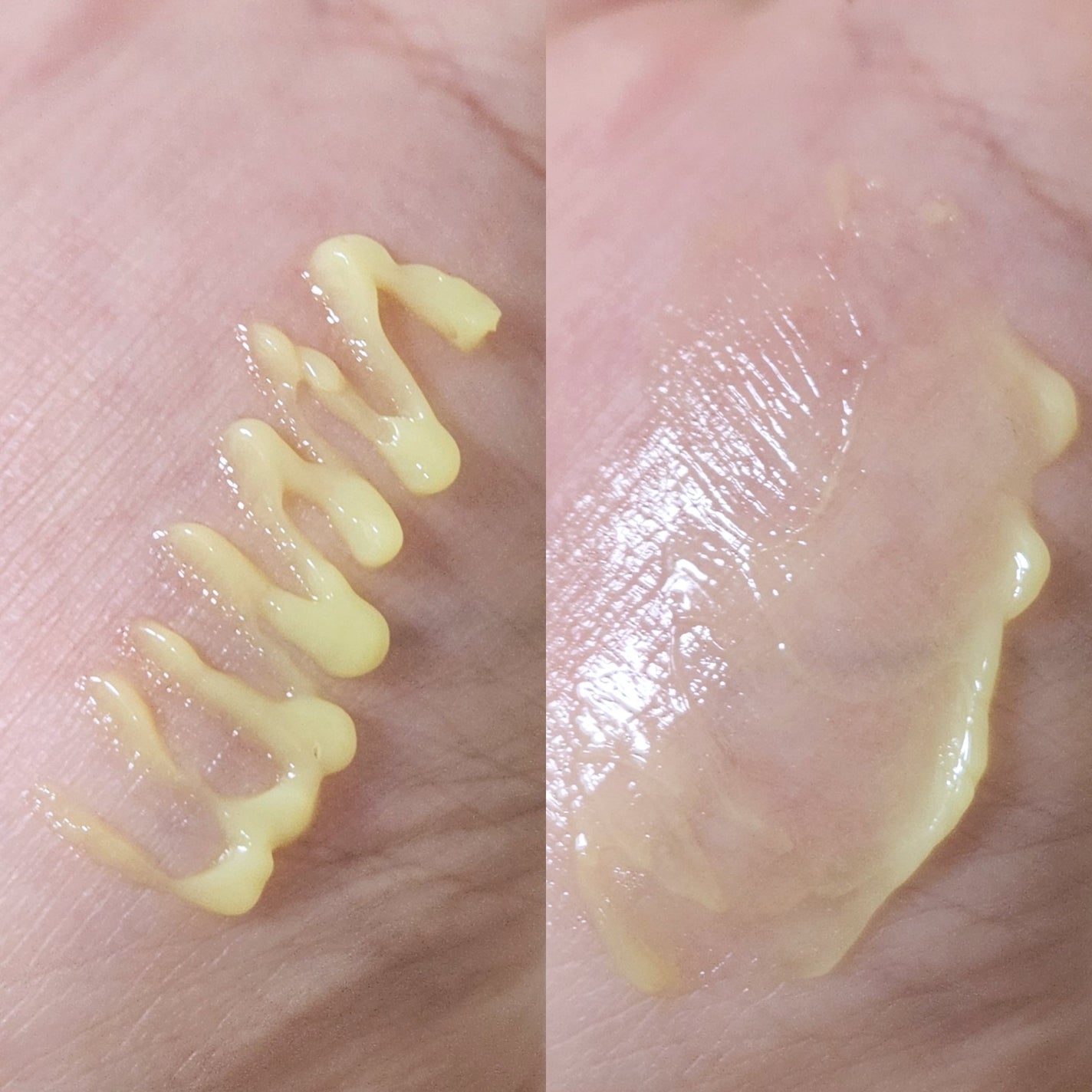 VITALIFT A forte/Dr.Different/フェイスクリームを使ったクチコミ(4枚目)