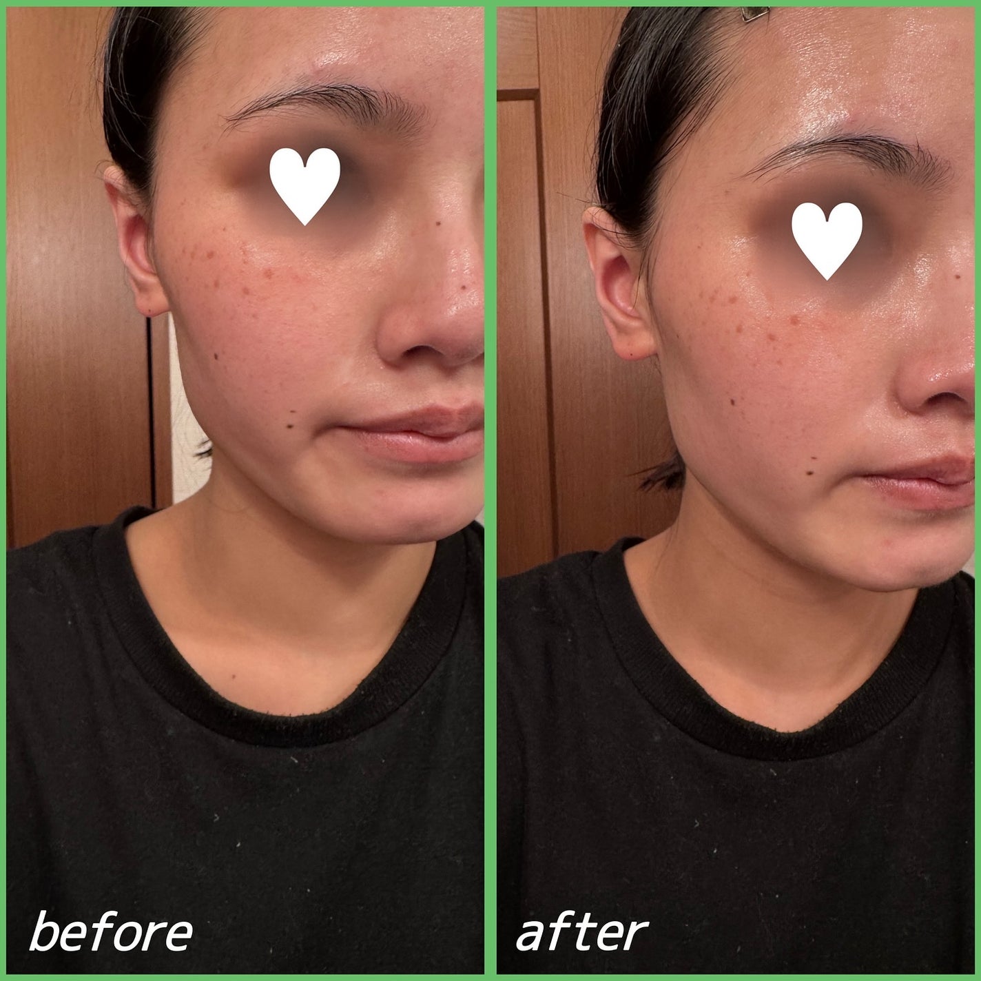 ダムトーン ポアトーンニングアキュエッセンス/ダムトーン/美容液を使ったクチコミ(5枚目)