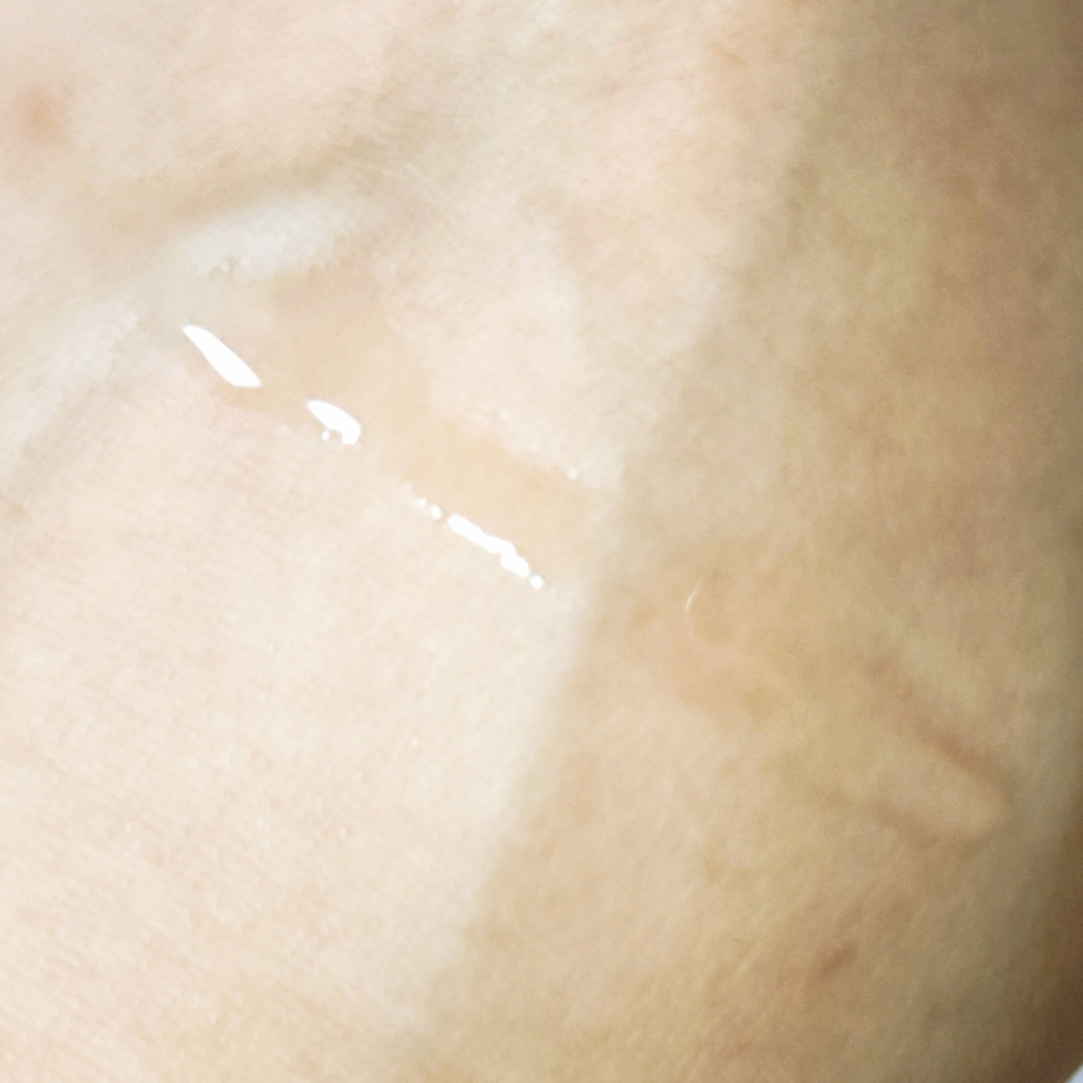 セラミド配合化粧水/Amazon/化粧水を使ったクチコミ（2枚目）