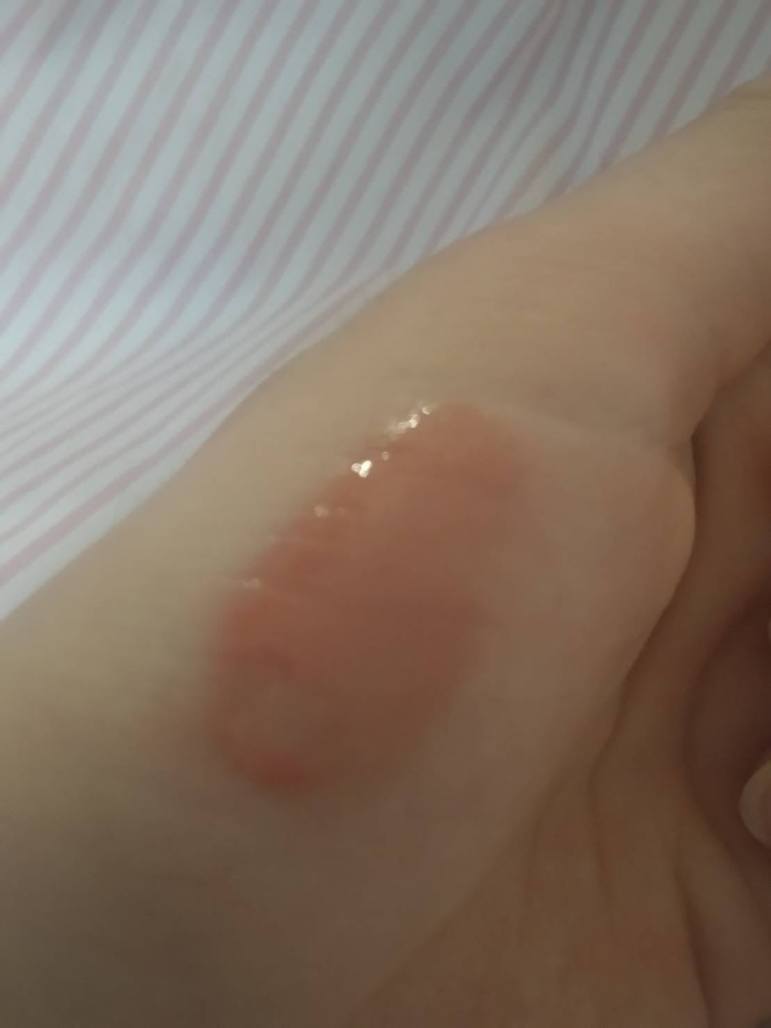 グレイズバウンシングティント/2aN/リップティントを使ったクチコミ(3枚目)